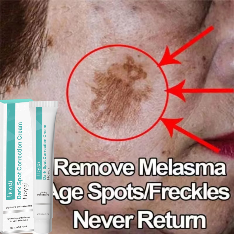 Powerful Spot-removing Whiten  - Luxury Skincare Brands review and price