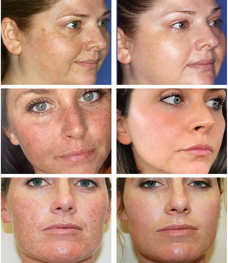 Powerful Spot-removing Whiten  - Luxury Skincare Brands review and price