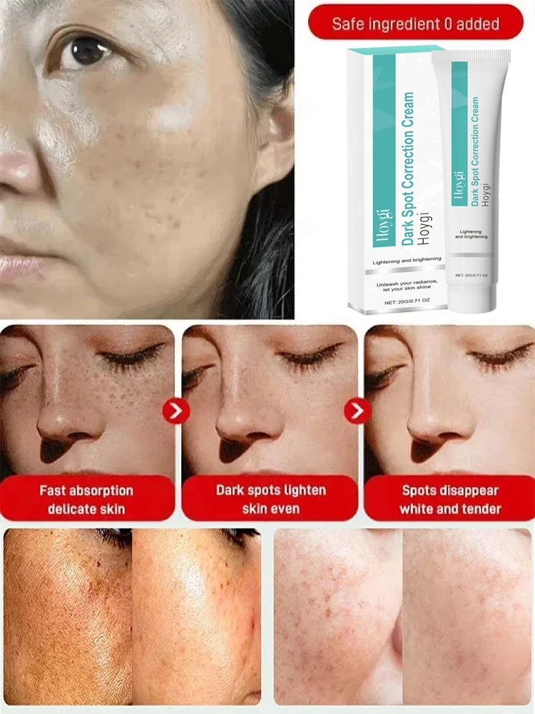 Powerful Spot-removing Whiten  - Luxury Skincare Brands review and price
