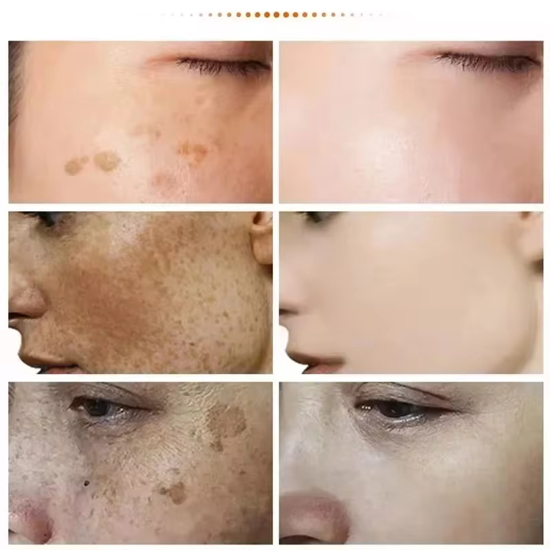 Powerful Spot-removing Whiten  - Luxury Skincare Brands review and price