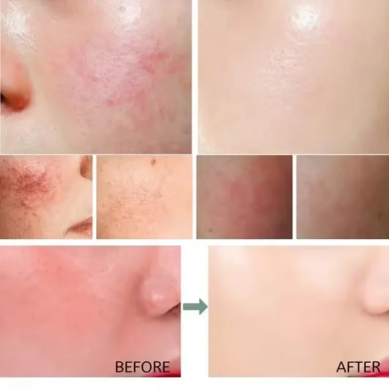 Facial Redness Repair Cream Im - Luxury Skincare Brands review and price