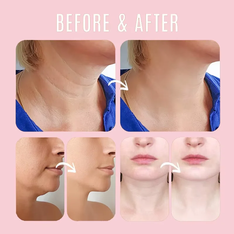 Collagen Wrinkle Removal Multi - Luxury Skincare Brands review and price